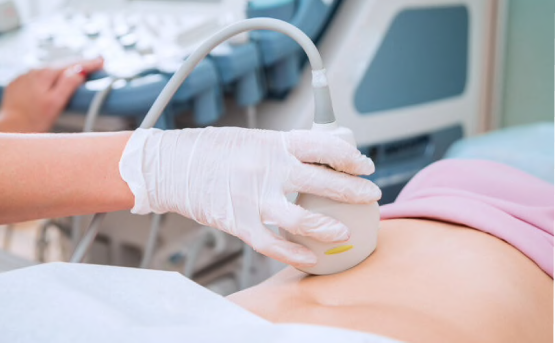 Ultratovush diagnostikasi